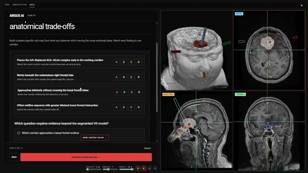 Argus case step matching anatomical findings to surgical corridors beside a 3D head model and linked MRI views
