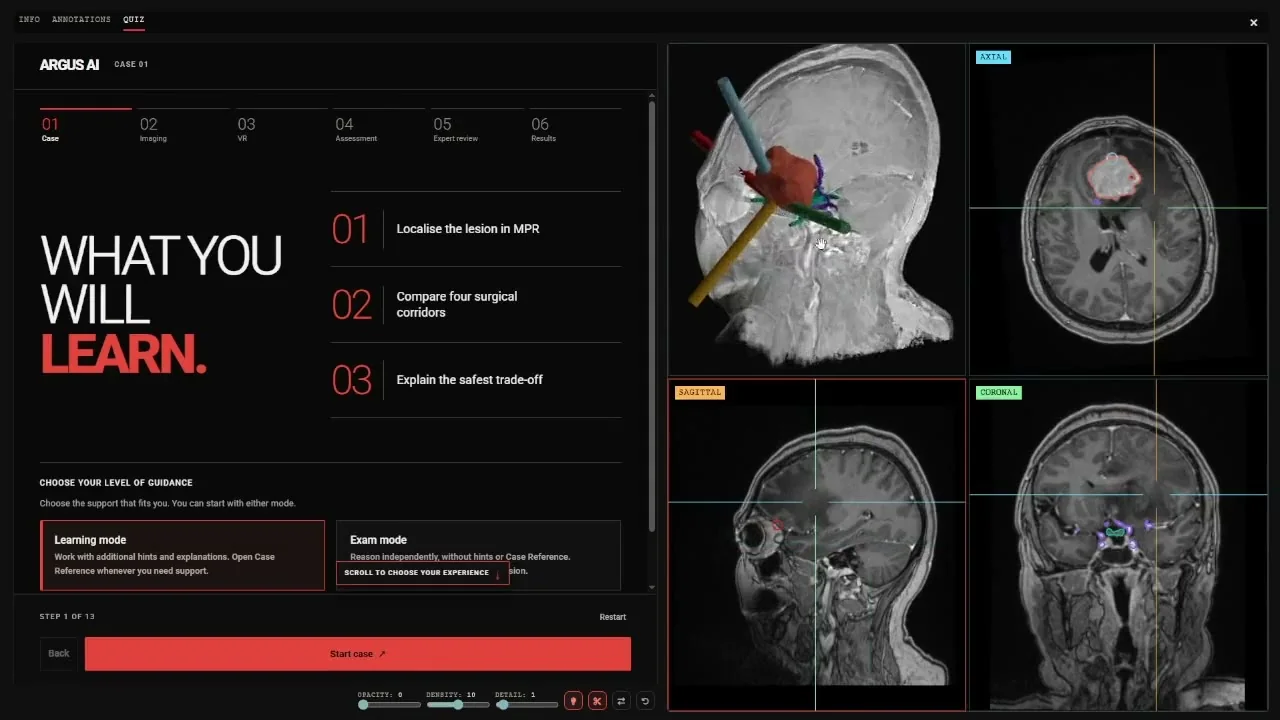 Argus case introduction listing the learning objectives beside a 3D head model with surgical corridors and axial, sagittal and coronal MRI views
